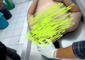 Satu Warga Binaan Rutan Kelas IIA Batam Dinyatakan Tewas